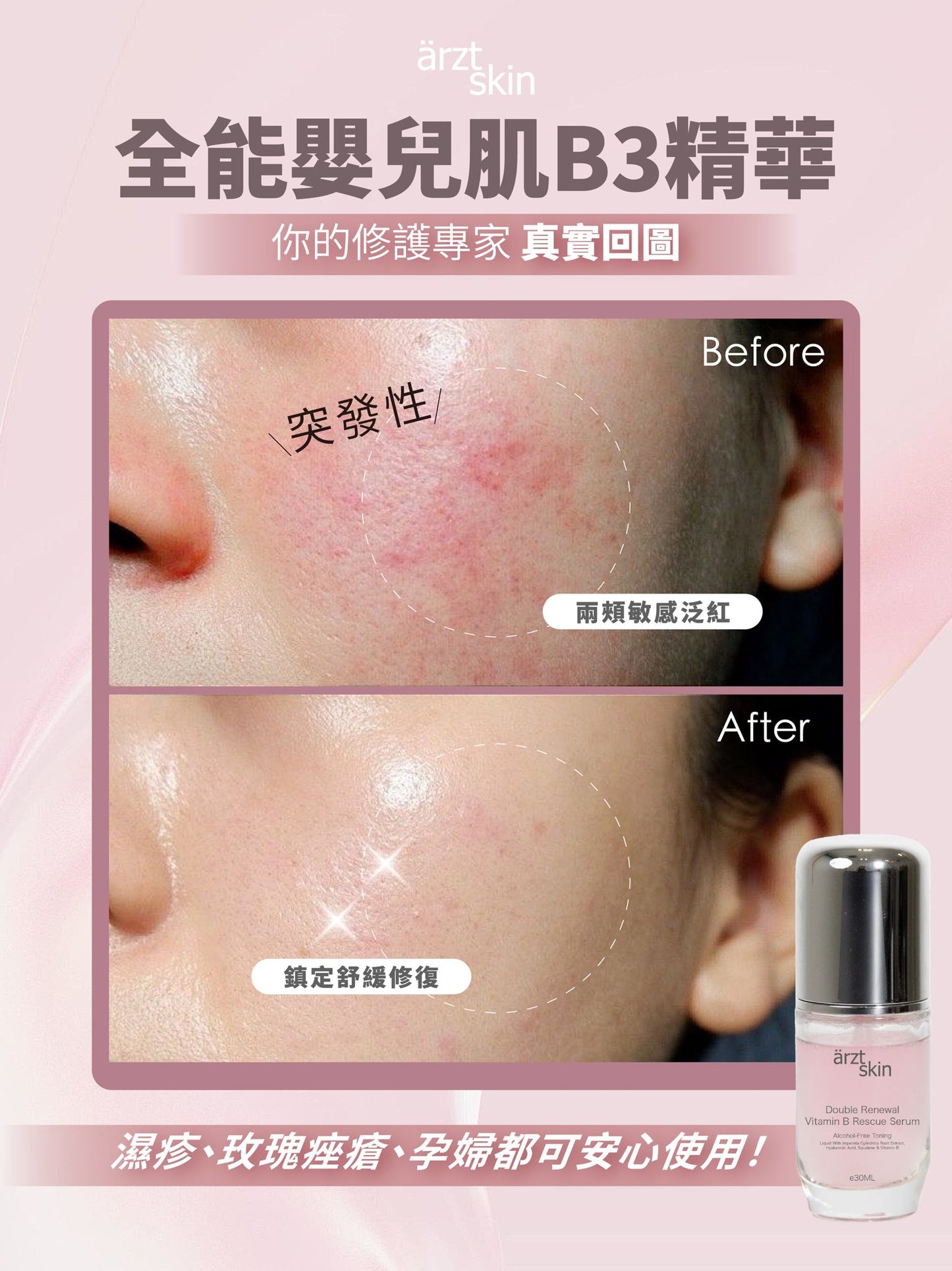 【裕美優惠】ärzt skin全能嬰兒肌B3精華30ML 買一送一